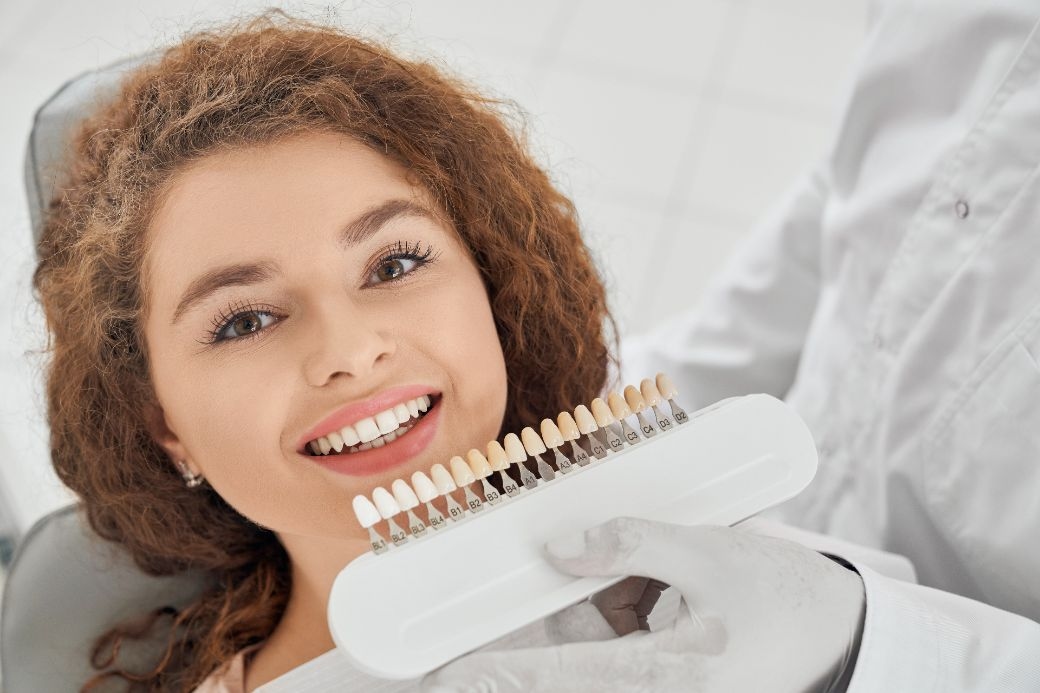 Albire dentară profesională realizată la clinica Dr. Kurbe din București