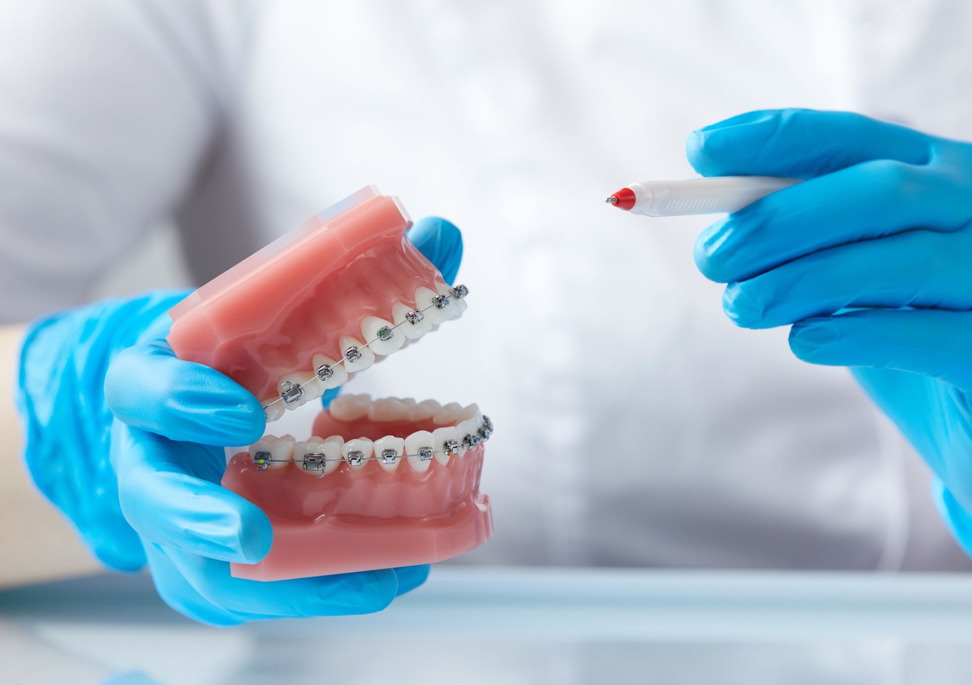 Aparat dentar la inceput de an scolar ghid pentru parinti clinica Dr Kurbe