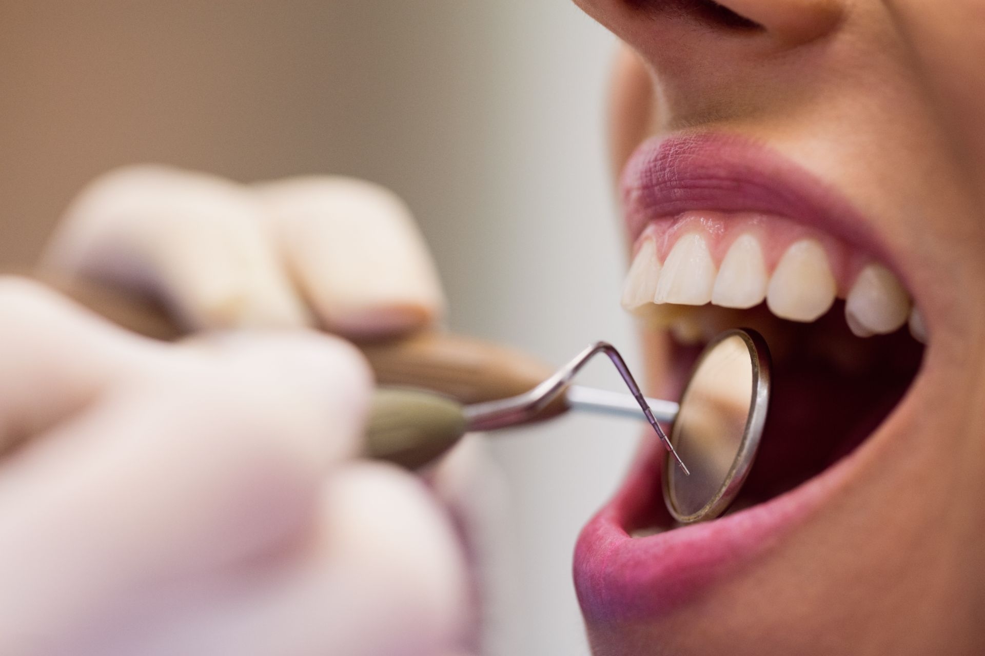 Tartrul dentar si boala parodontala detartraj cu ultrasunete Clinica Dr Kurbe