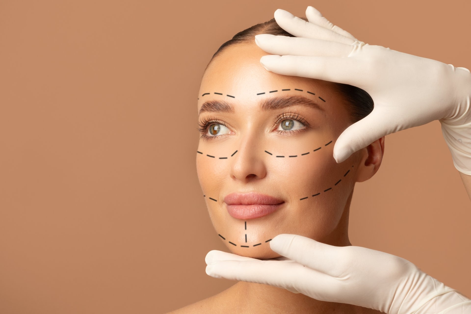 Etapele interventiei chirurgicale de lifting facial SMAS la Clinica Dr Kurbe Bucuresti