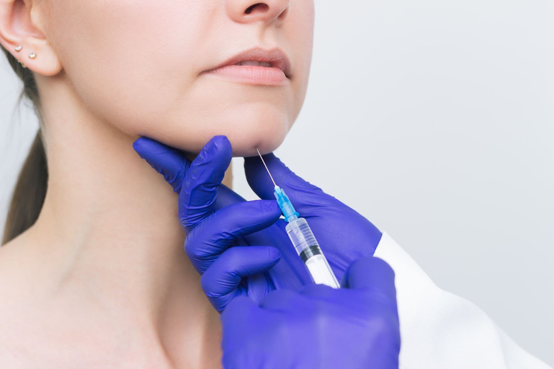 Botox in menton (Augmentare menton)