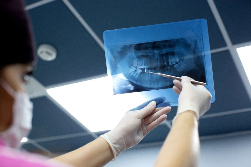 Radiologia dentară la copii