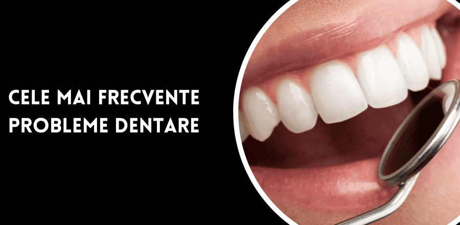Cele mai frecvente probleme dentare