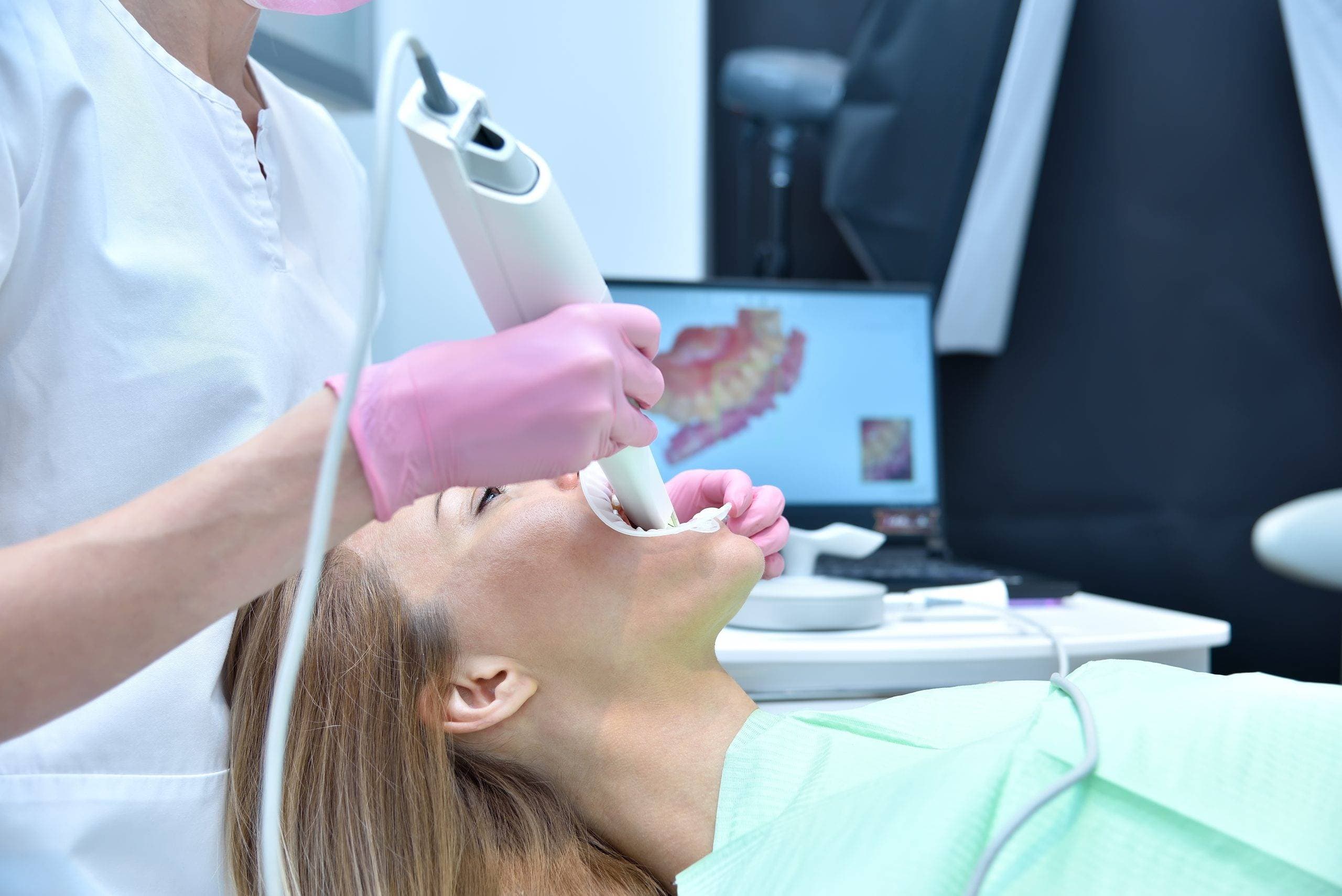 dental 3d scanner