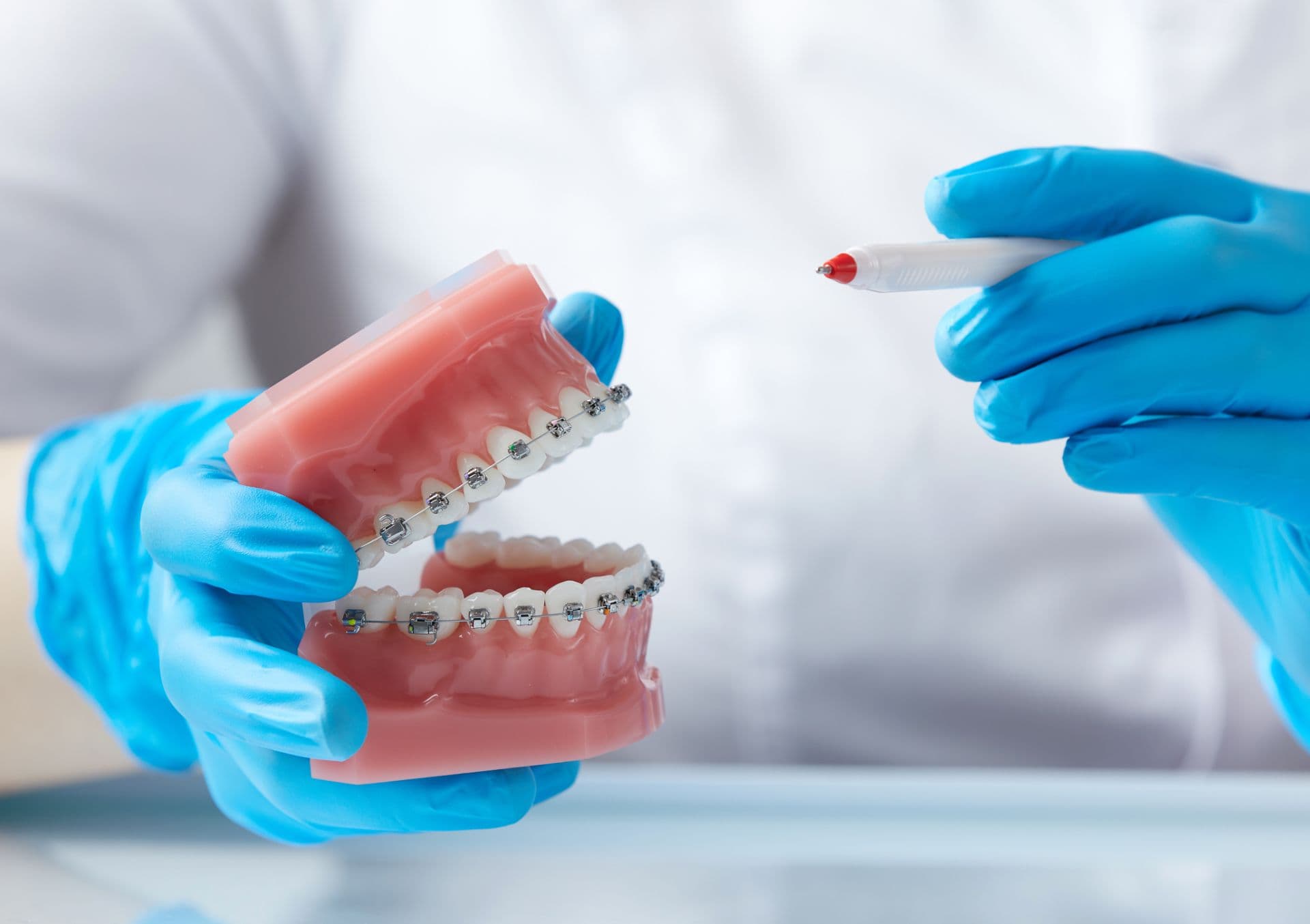 Aparat dentar la inceput de an scolar ghid pentru parinti clinica Dr Kurbe