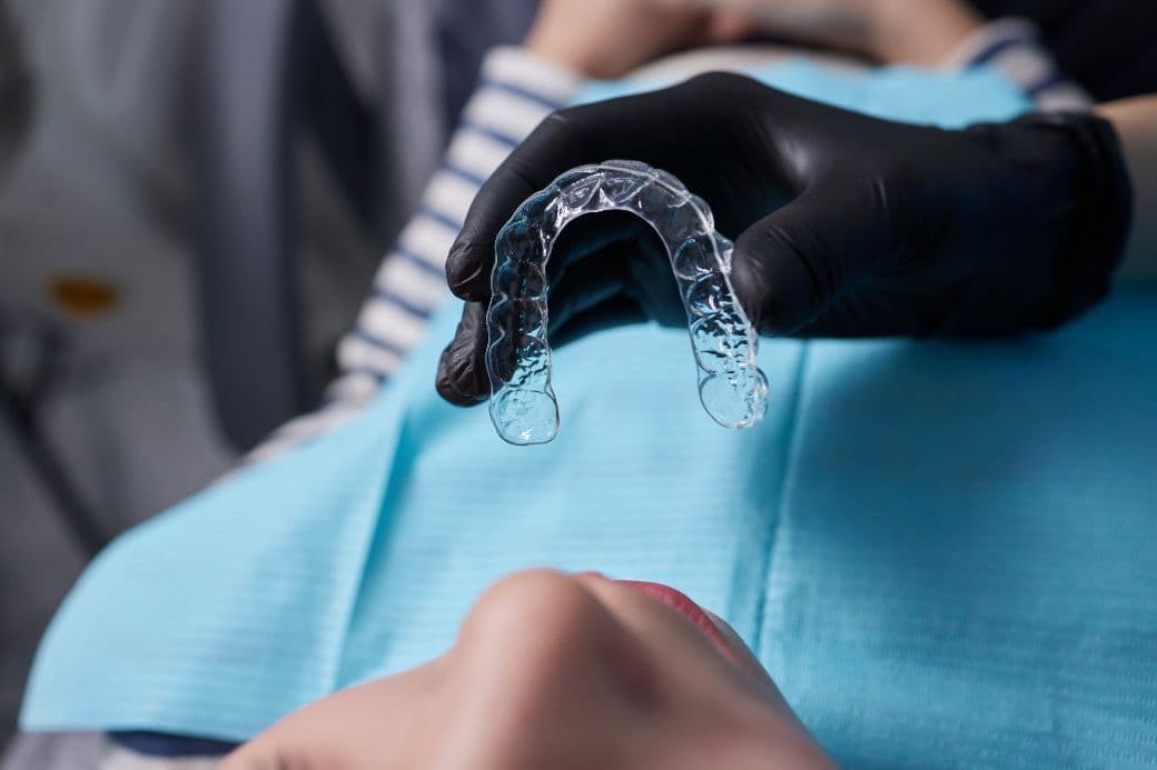 De ce este nevoie de gutiera dentară?