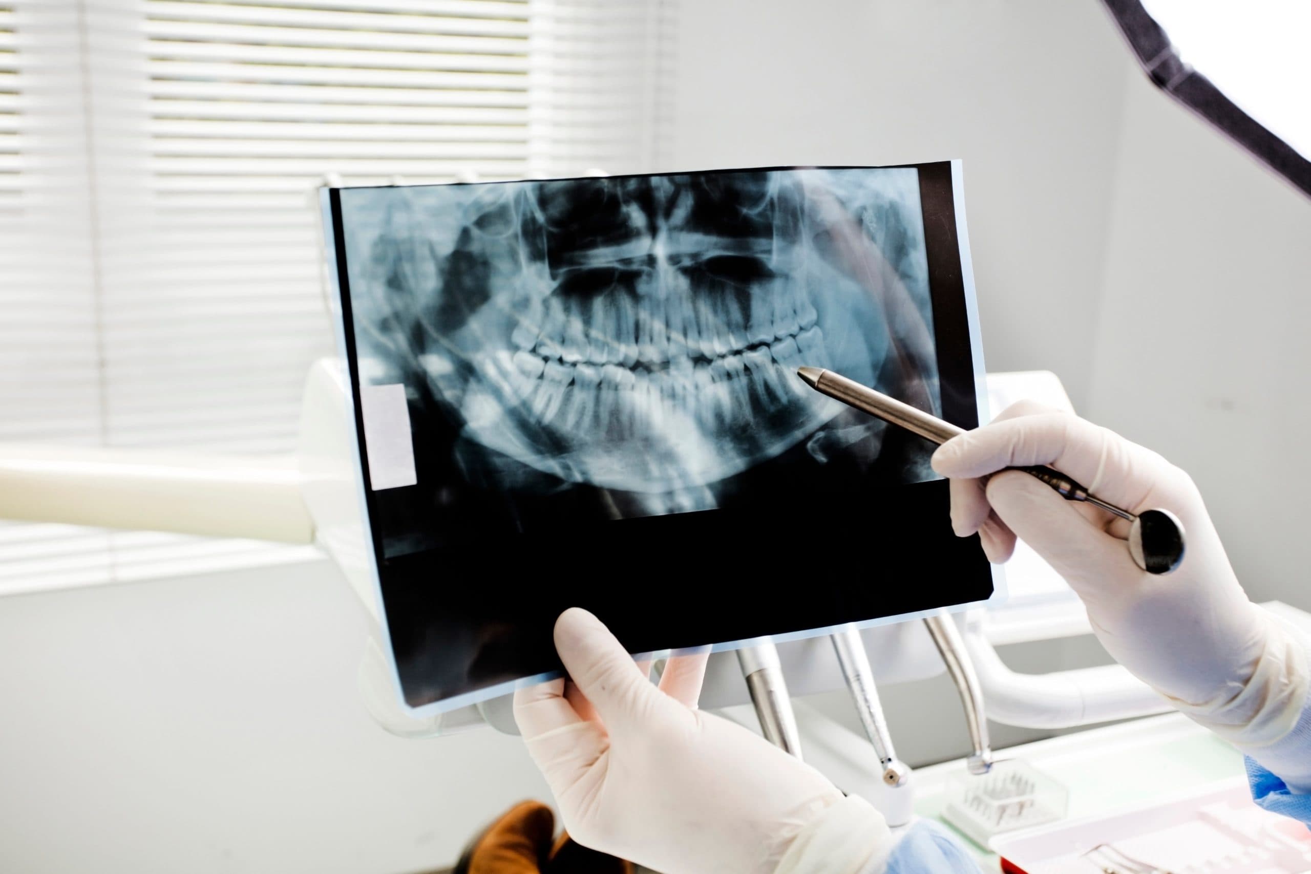 dental X-ray
