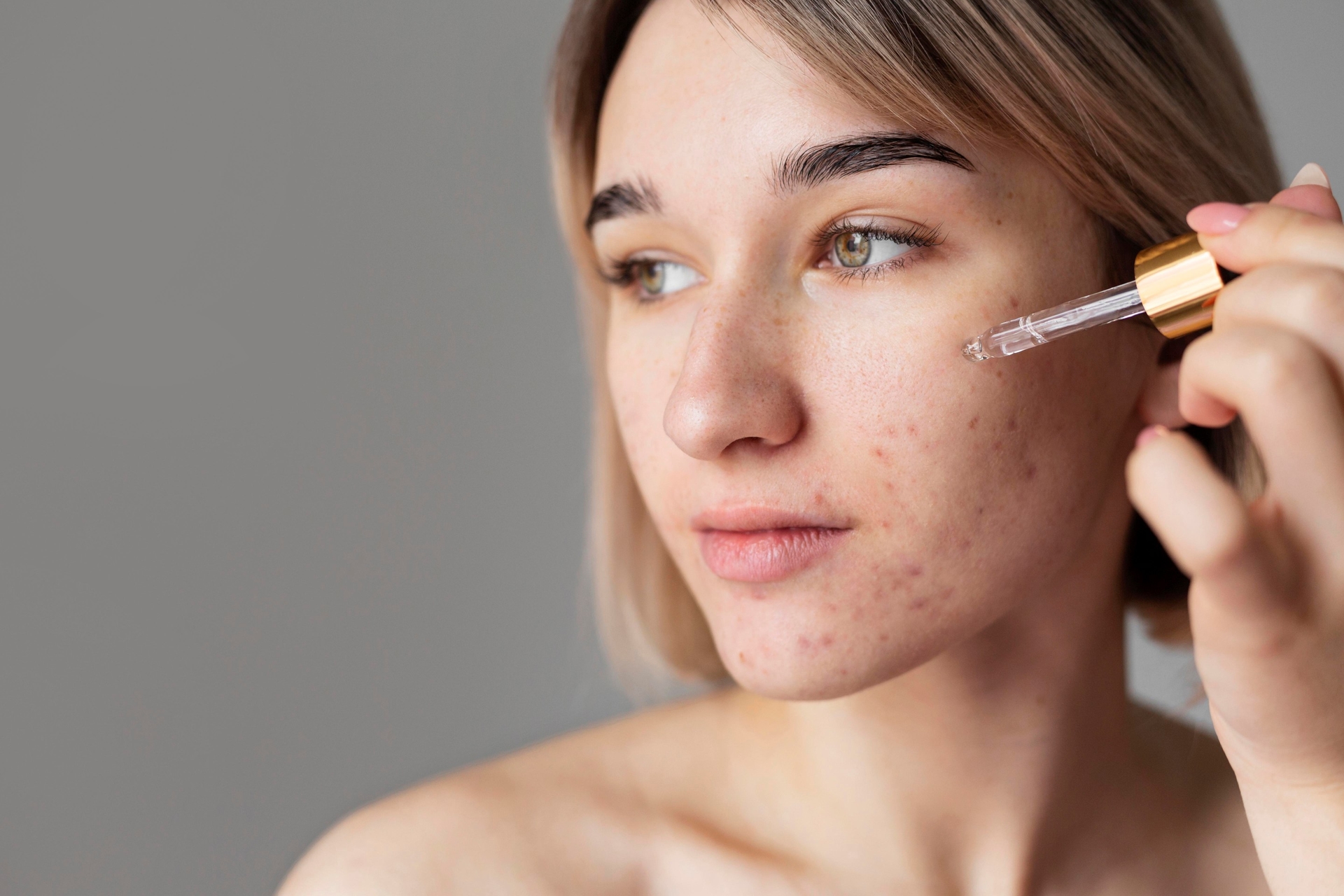 Tratament dermatologic eficient pentru acnee și cicatrici post-acneice la Clinica Dr. Kurbe