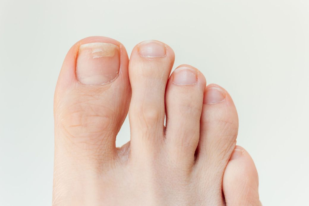Ingrijirea unghiilor casante si prevenirea exfolierii dupa manichiura tehnica