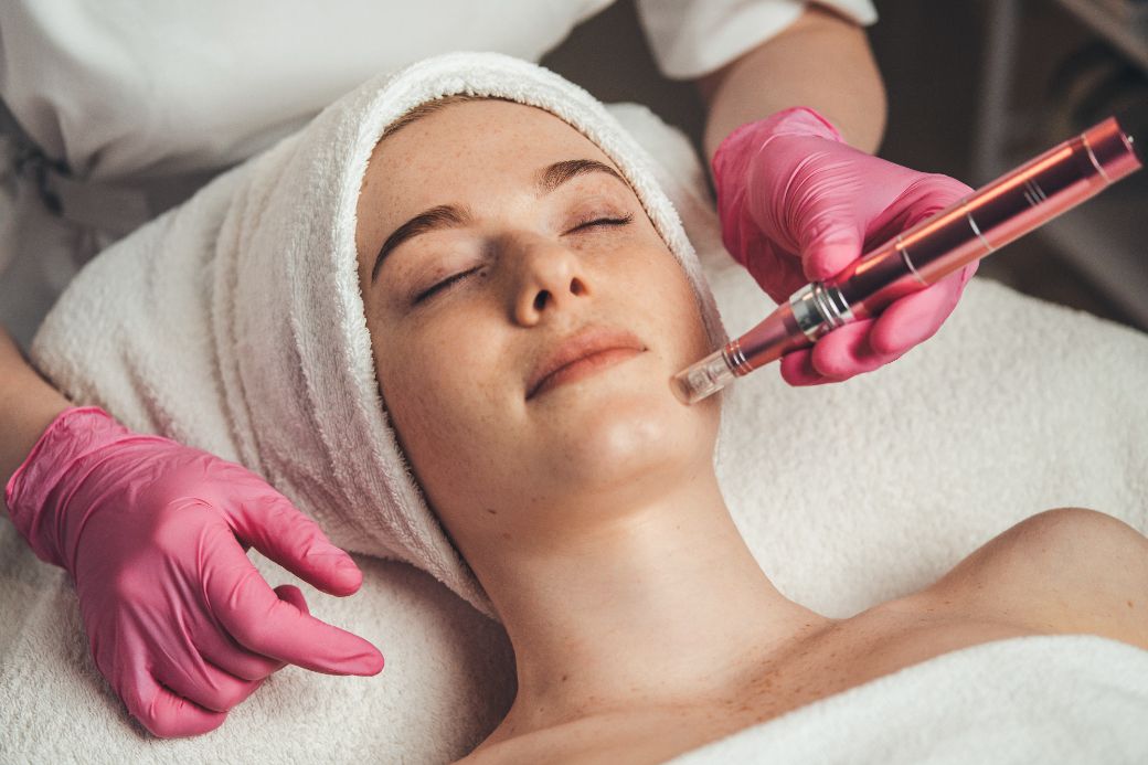 Protocol full-face cu exozomi și polinucleotide aplicat prin microneedling Dermapen 4