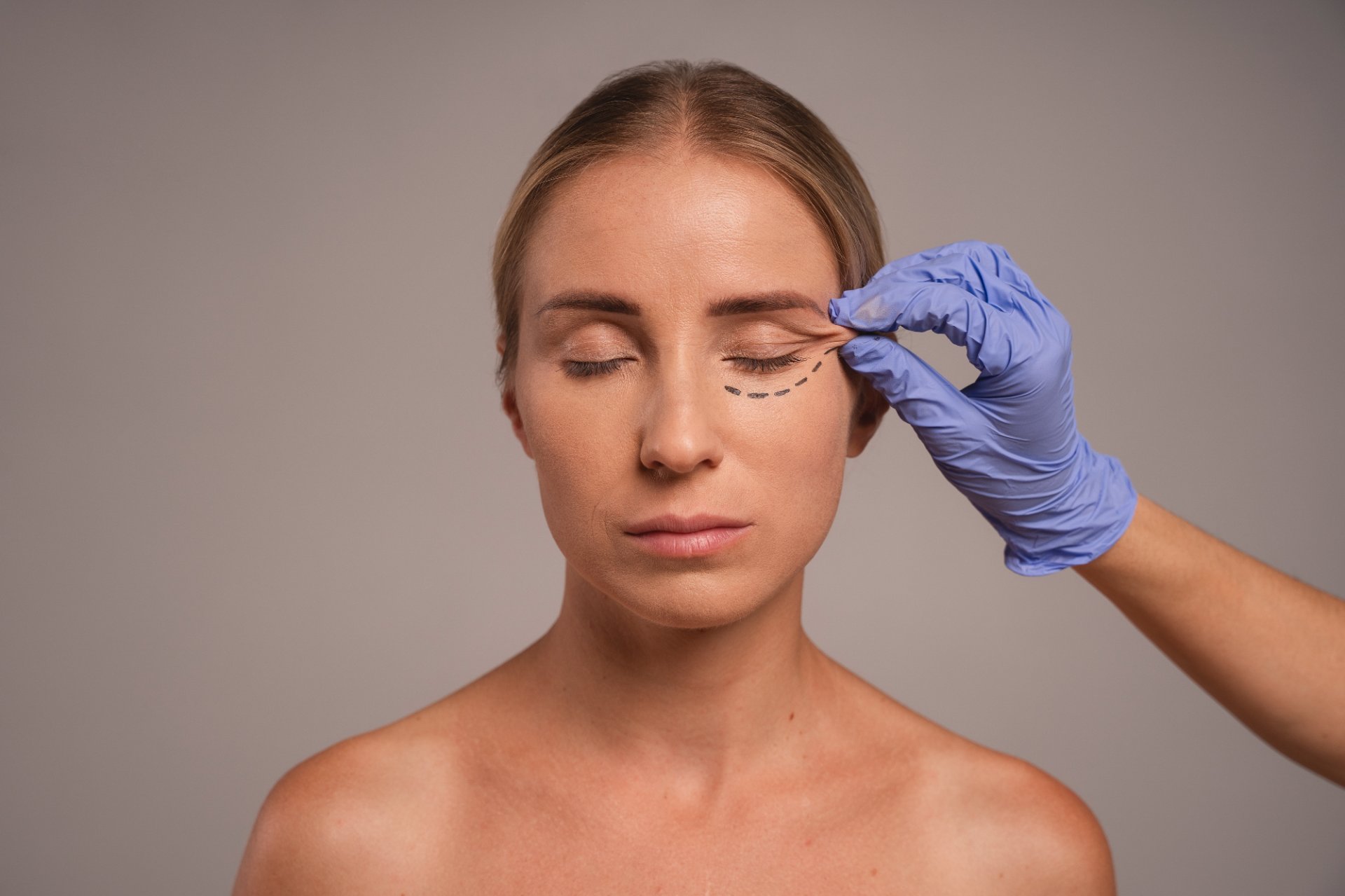 Efect de lifting al privirii si intinerire perioculara la Clinica Dr. Kurbe