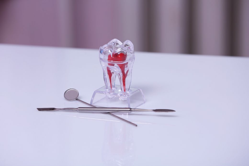 Thorough disinfection and 3D filling of infected dental root canals