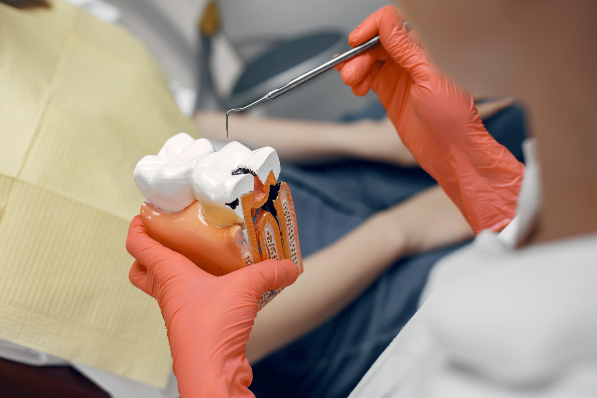 Obturație dentară estetică din compozit realizată la Clinica Dr. Kurbe București