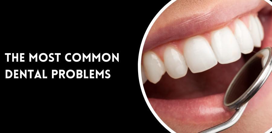 The most common dental problems